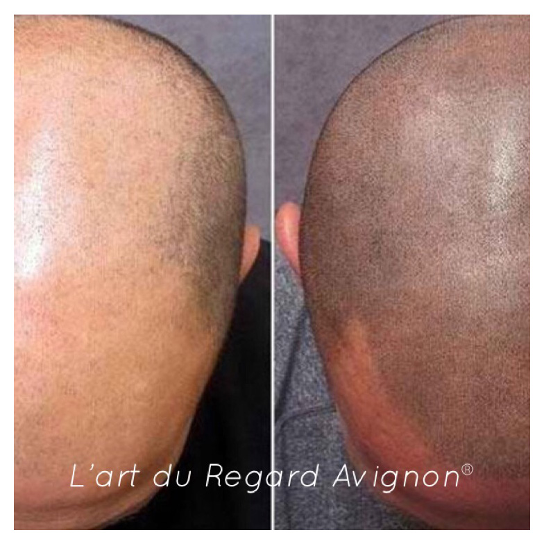 pigmentation-reparatrice-cheveux